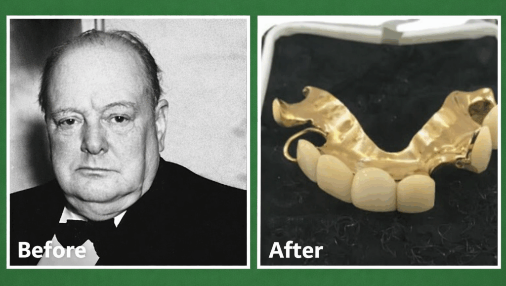 Celebrity Denture Transformations