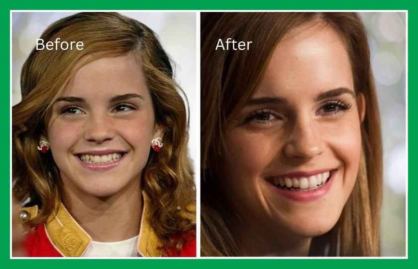 Emma Watson