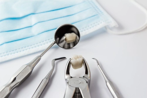 The Process of Tooth Extraction